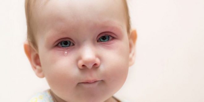 لون بنفسجي تحت العين عند الاطفال