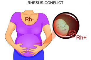 اختبار الحمل: عامل Rh وفحص الأجسام المضادة