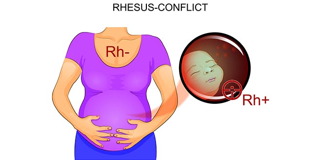 اختبار الحمل: عامل Rh وفحص الأجسام المضادة
