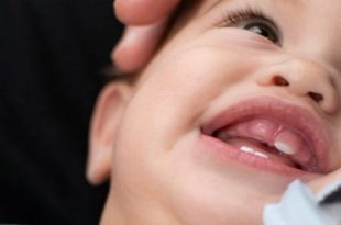 كيفية التعامل مع الأسنان الملتوية عند الأطفال الرضع