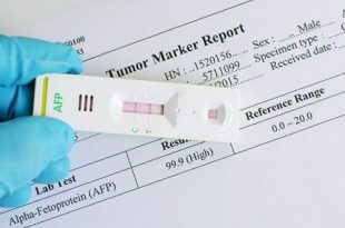 فحص الدم ألفا فيتوبروتين (AFP) أثناء الحمل