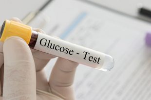 اختبار تحدي الجلوكوز واختبار تحمل الجلوكوز هما اختباران يتم إجراؤهما لتشخيص داء سكري الحمل. تعرف على كل ما تيمكن معرفته عن هذه الاختبارات وكيف يتم تنفيذها.