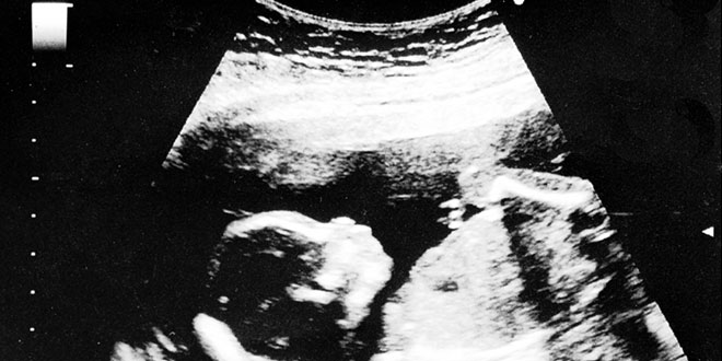 الموجات فوق الصوتية الحوامل في الأسبوع السابع عشر: الإجراء، وجود تشوهات، وغير ذلك الكثير