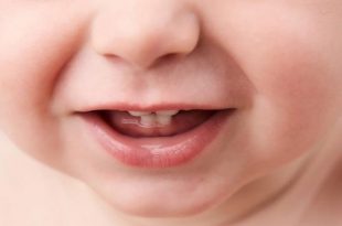 أسنان الولادة - الأنواع والأسباب والرعاية المنزلية