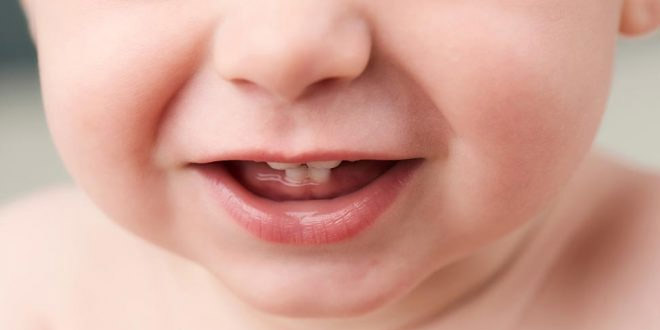 أسنان الولادة - الأنواع والأسباب والرعاية المنزلية