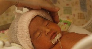 الطفل المولود في الأسبوع 34: الأسباب والمضاعفات وكيفية العناية