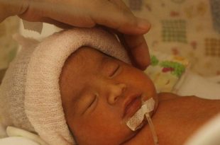 الطفل المولود في الأسبوع 34: الأسباب والمضاعفات وكيفية العناية