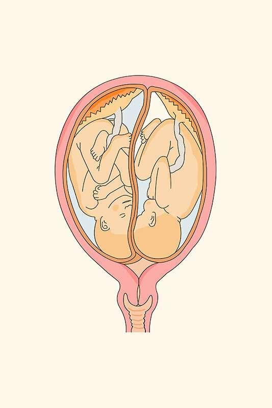 اسباب التفاف الحبل السري حول الجنين