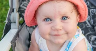 الوحمة عند الرضع: الأسباب والأنواع والمزيد