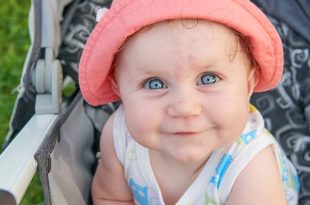 الوحمة عند الرضع: الأسباب والأنواع والمزيد
