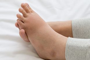 آلام القدم أثناء الحمل