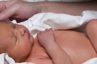 شعر جسم الطفل عند حديثي الولادة: الأسباب والتشخيص