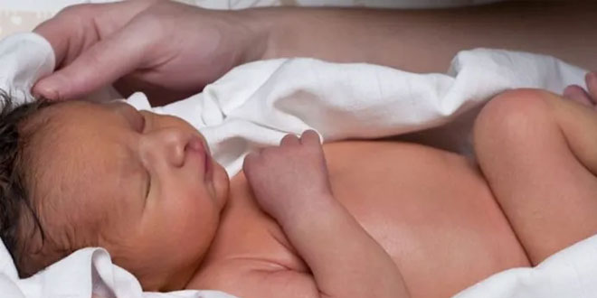 شعر جسم الطفل عند حديثي الولادة: الأسباب والتشخيص