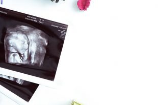 التصوير بالموجات فوق الصوتية ثلاثية ورباعية الأبعاد أثناء الحمل