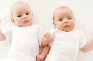 التوائم أحادية المشيمة أحادية الغائط (MoMo)